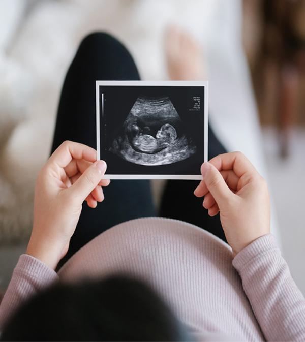 Woman holding an ultrasound image of her baby